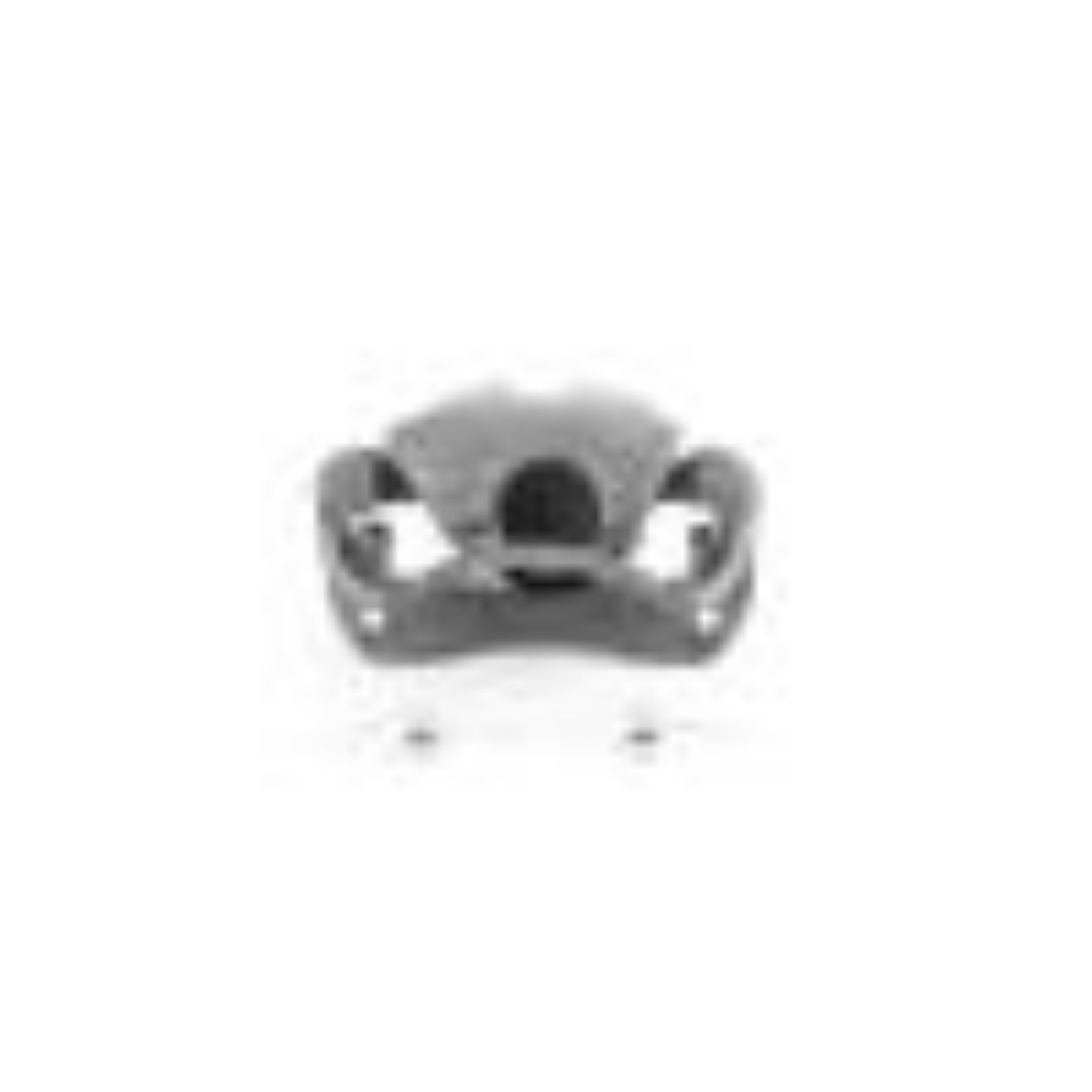 Picture of Power Stop 13-17 Lexus ES300h Front Right Autospecialty Caliper w-Bracket
