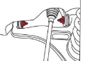 Picture of SPC Performance Mercedes C Class Camber-Caster Cam